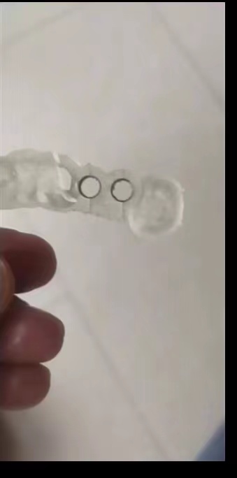 Guide de plantation d'impriman - 3D Printing Uv Resin avis et prix